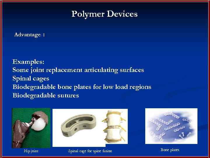 Polymer Devices Advantages: Examples: Some joint replacement articulating surfaces Spinal cages Biodegradable bone plates