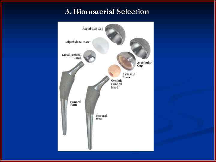 3. Biomaterial Selection 