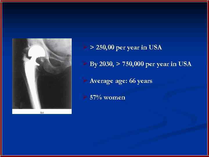 Ø > 250, 00 per year in USA Ø By 2030, > 750, 000