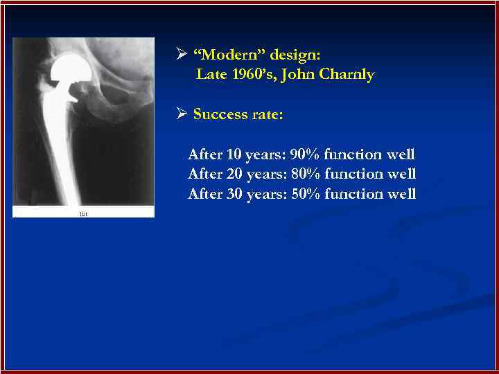 Ø “Modern” design: Late 1960’s, John Charnly Ø Success rate: After 10 years: 90%