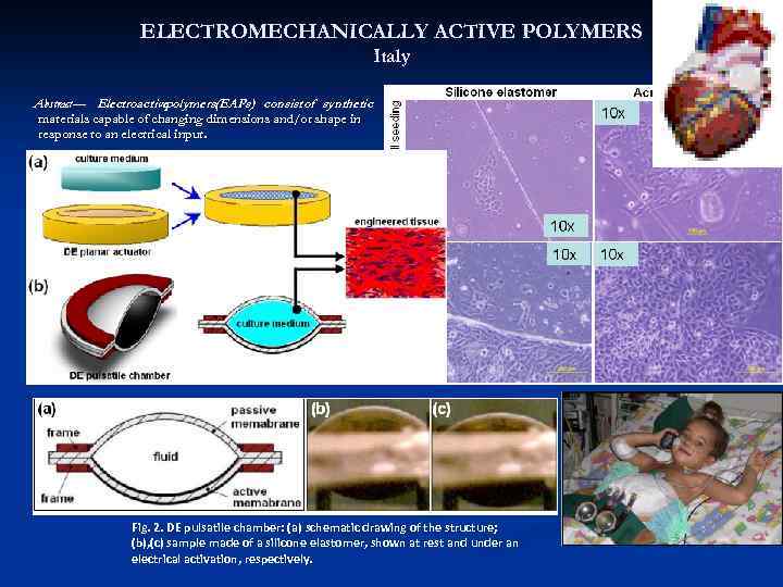 ELECTROMECHANICALLY ACTIVE POLYMERS Italy Abstract— Electroactive polymers(EAPs) consist of synthetic materials capable of changing