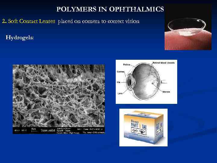 POLYMERS IN OPHTHALMICS 2. Soft Contact Lenses: placed on cornera to correct vision Hydrogels: