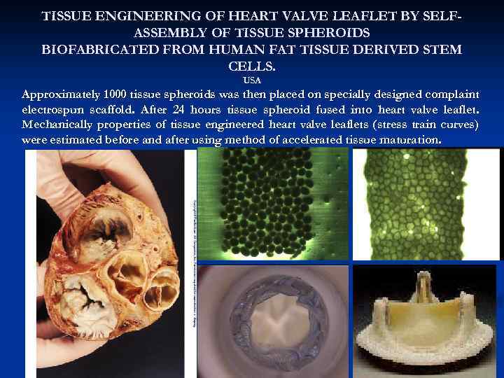 TISSUE ENGINEERING OF HEART VALVE LEAFLET BY SELFASSEMBLY OF TISSUE SPHEROIDS BIOFABRICATED FROM HUMAN