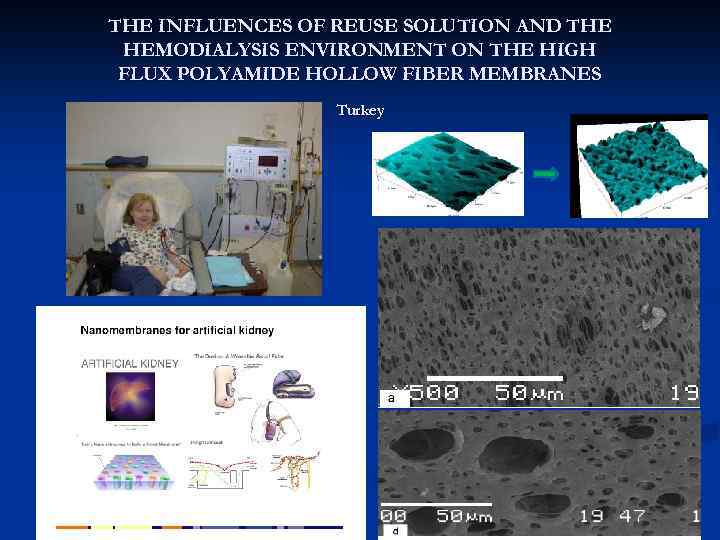 THE INFLUENCES OF REUSE SOLUTION AND THE HEMODIALYSIS ENVIRONMENT ON THE HIGH FLUX POLYAMIDE