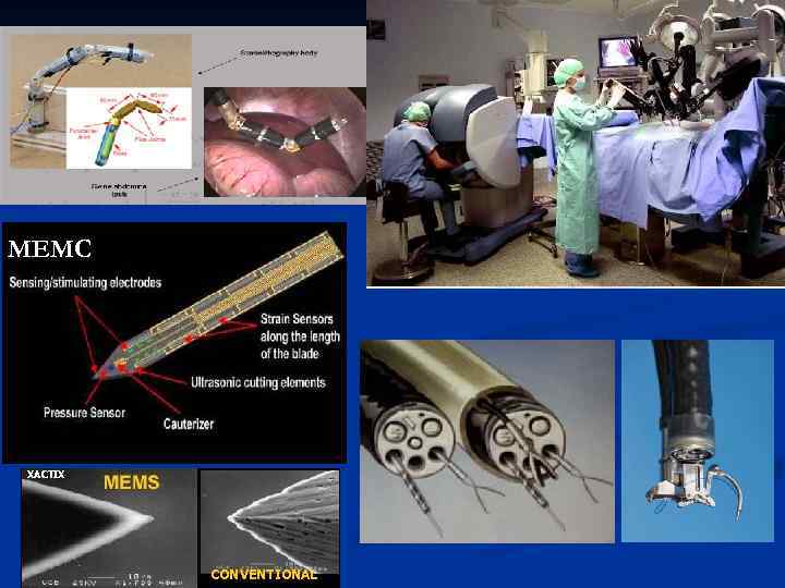 МЕМС XACTIX CONVENTIONAL 