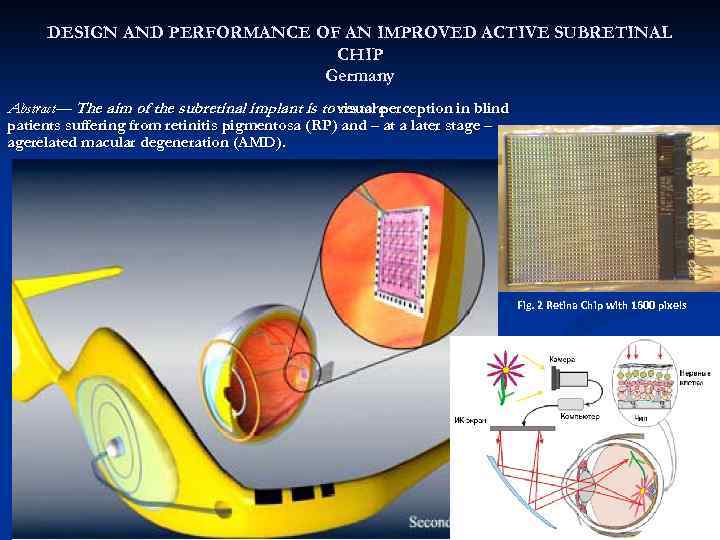 DESIGN AND PERFORMANCE OF AN IMPROVED ACTIVE SUBRETINAL CHIP Germany Abstract— The aim of