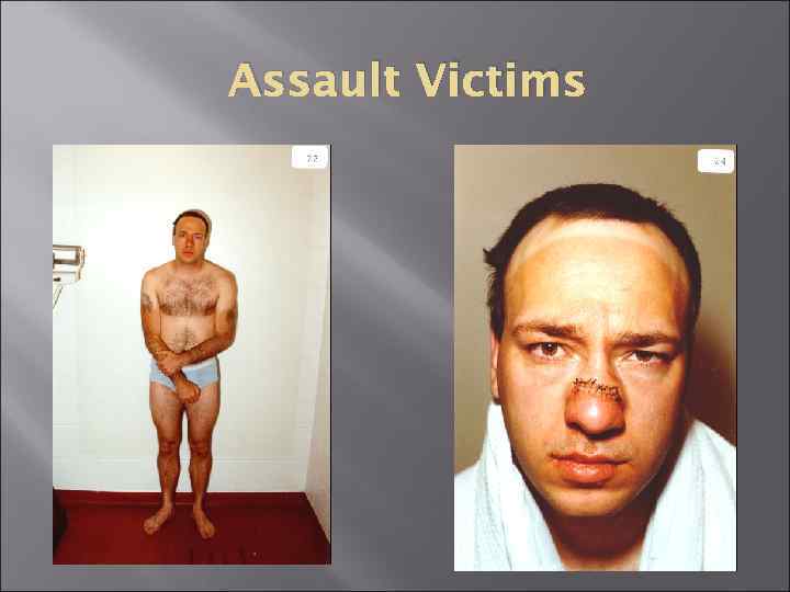 Assault Victims 