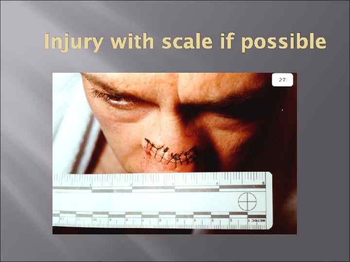 Injury with scale if possible 