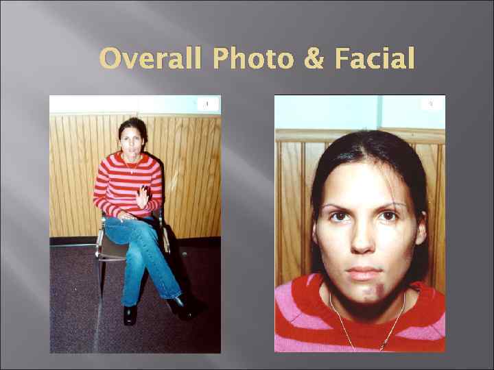 Overall Photo & Facial 