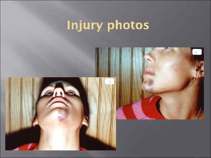 Injury photos 