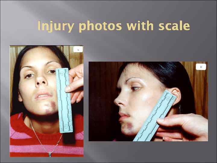 Injury photos with scale 