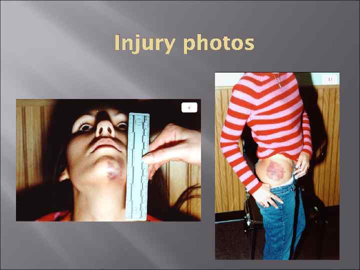 Injury photos 