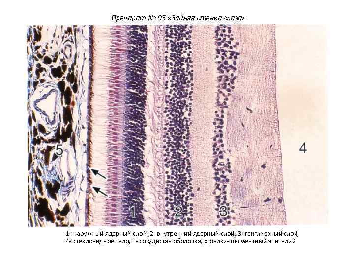Препарат № 95 «Задняя стенка глаза» 1 - наружный ядерный слой, 2 - внутренний