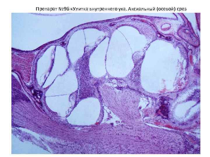 Препарат № 96 «Улитка внутреннего уха. Аксиальный (осевой) срез 