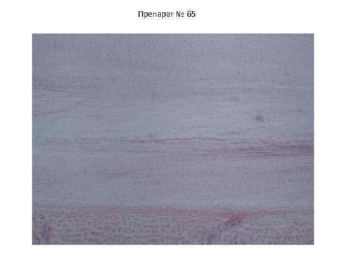 Препарат № 65 