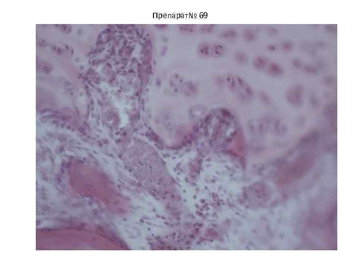 Препарат№ 69 