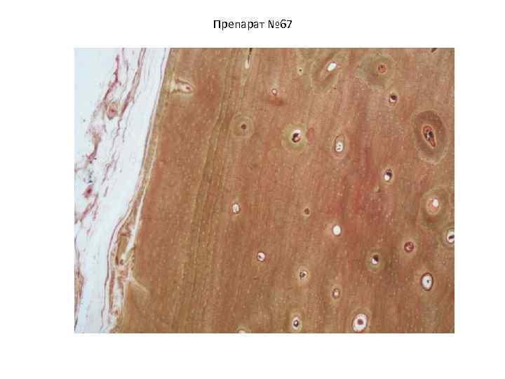Препарат № 67 