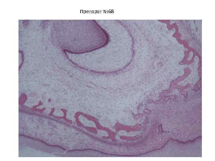 Препарат № 68 