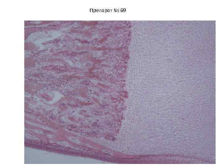 Препарат № 69 