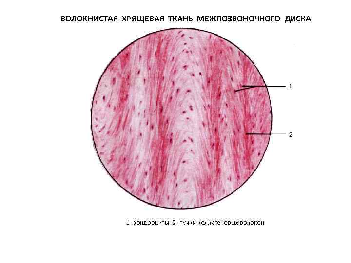 Какая ткань изображена на картинке хрящевые ткани