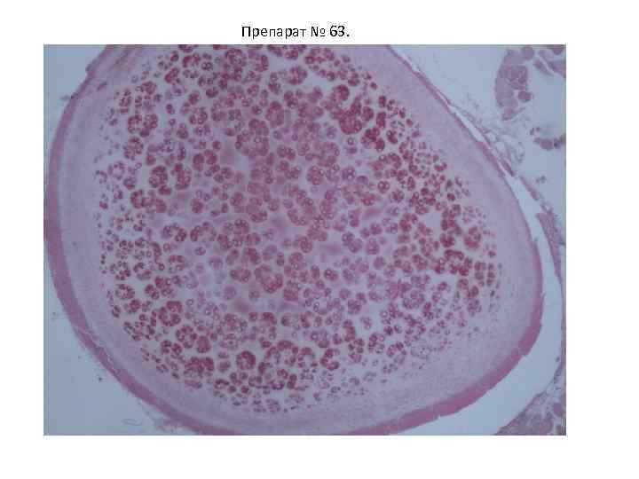 Препарат № 63. 