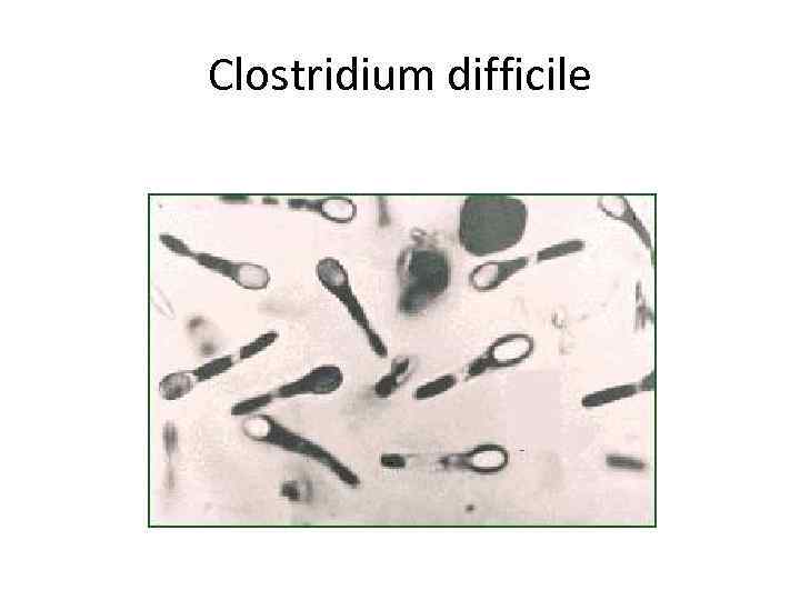 Клостридиум диффициле. Морфология клостридиум диффициле. Морфология клостридий. Clostridium difficile микробиология.