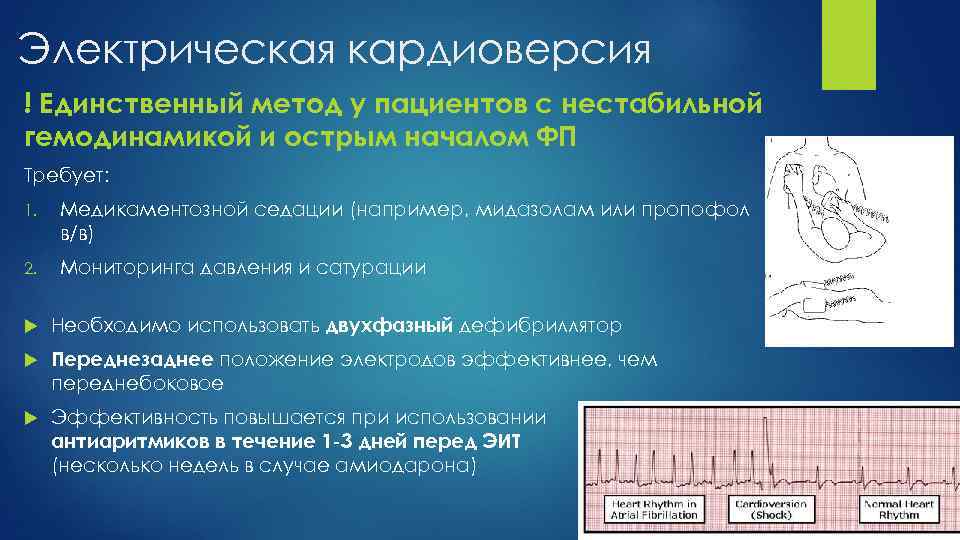 Электрическая кардиоверсия ! Единственный метод у пациентов с нестабильной гемодинамикой и острым началом ФП