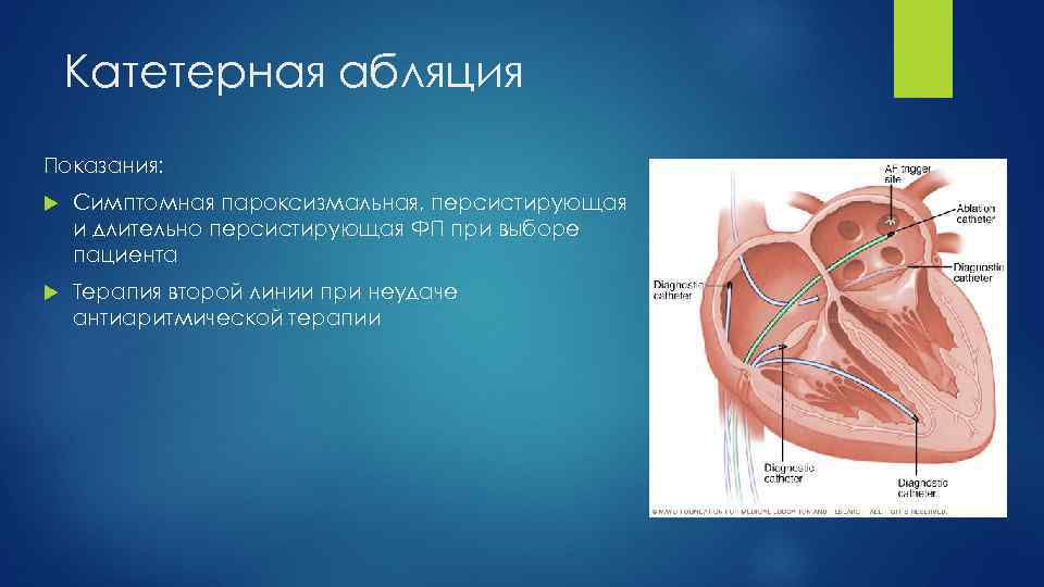 Катетерная абляция Показания: Симптомная пароксизмальная, персистирующая и длительно персистирующая ФП при выборе пациента Терапия