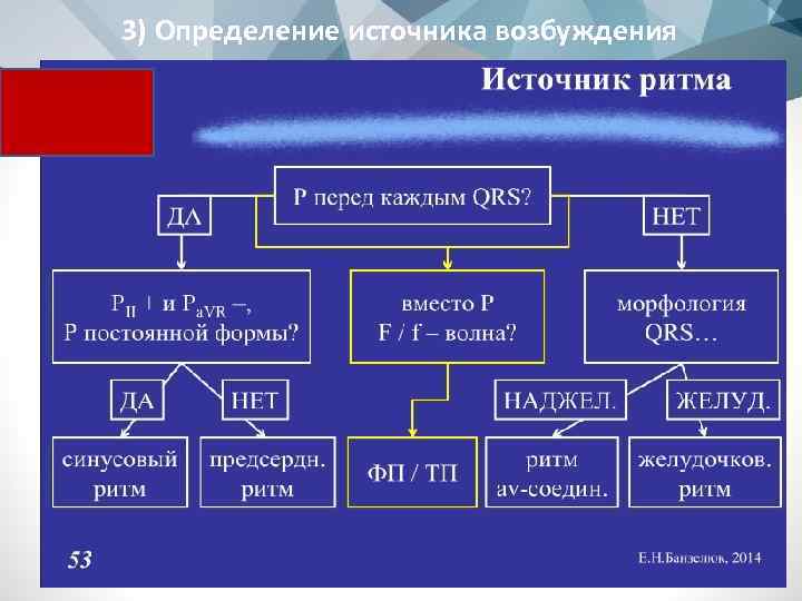 3) Определение источника возбуждения 