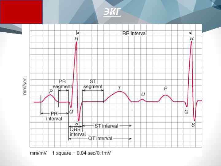 ЭКГ 