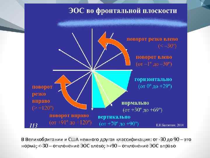 В Великобритании и США немного другая классификация: от -30 до 90 – это норма;