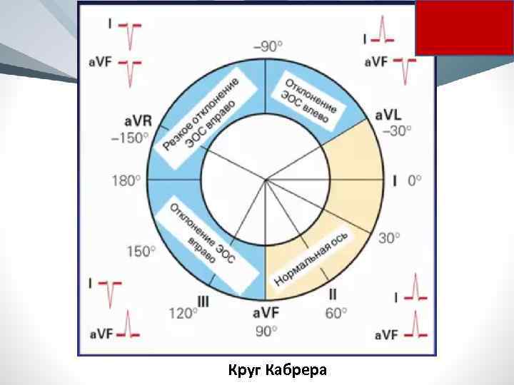 Круг Кабрера 