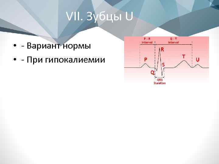 VII. Зубцы U • - Вариант нормы • - При гипокалиемии 