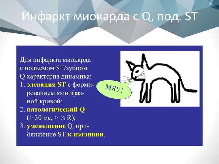 Инфаркт миокарда с Q, под. ST 
