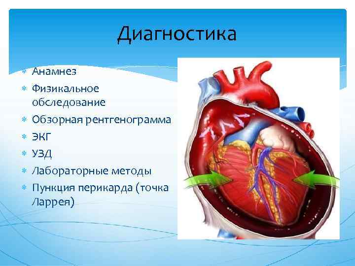 Диагностика Анамнез Физикальное обследование Обзорная рентгенограмма ЭКГ УЗД Лабораторные методы Пункция перикарда (точка Ларрея)