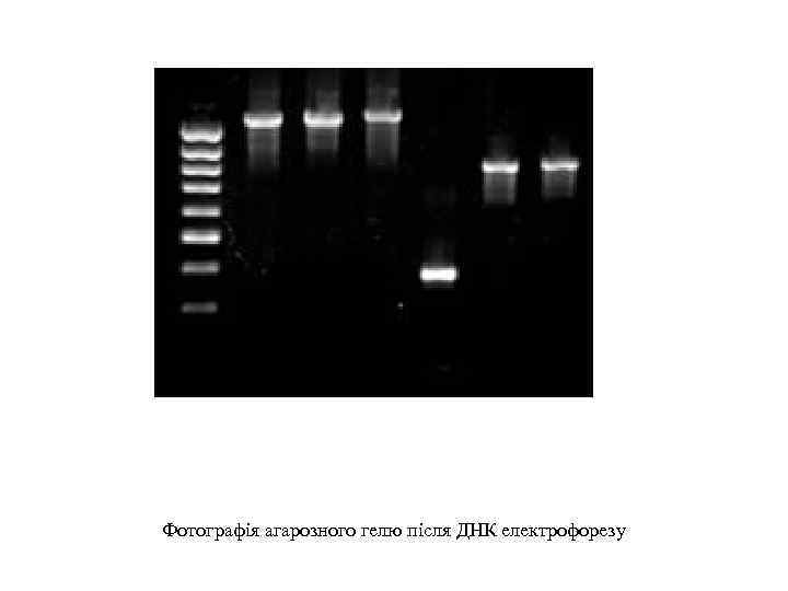 Фотографія агарозного гелю після ДНК електрофорезу 