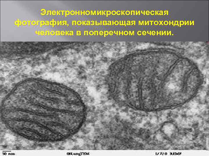 Электронномикроскопическая фотография, показывающая митохондрии человека в поперечном сечении. 