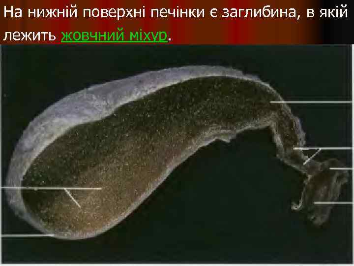 На нижній поверхні печінки є заглибина, в якій лежить жовчний міхур. 