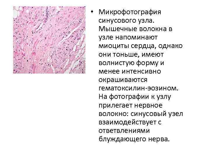  • Микрофотография синусового узла. Мышечные волокна в узле напоминают миоциты сердца, однако они