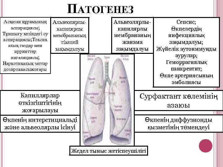 ПАТОГЕНЕЗ Асқазан құрамының Альвеолярлыаспирациясы; капилярлы Тұншығу кезіндегі су мембрананың аспирациясы; Токсик тікелей алық газдар