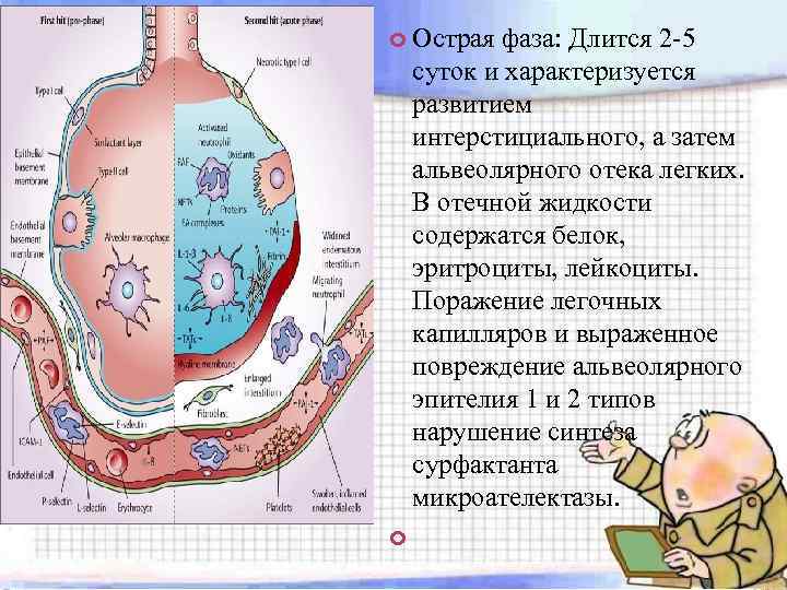  Острая фаза: Длится 2 -5 суток и характеризуется развитием интерстициального, а затем альвеолярного