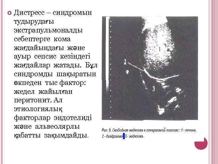  Дистресс – синдромын тудырудағы экстрапульмоналды себептерге кома жағдайындағы және ауыр сепсис кезіндегі жағдайлар