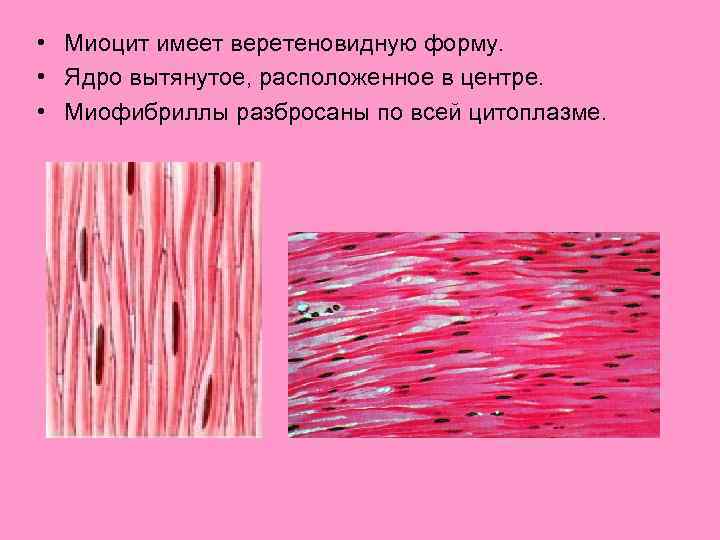  • Миоцит имеет веретеновидную форму. • Ядро вытянутое, расположенное в центре. • Миофибриллы