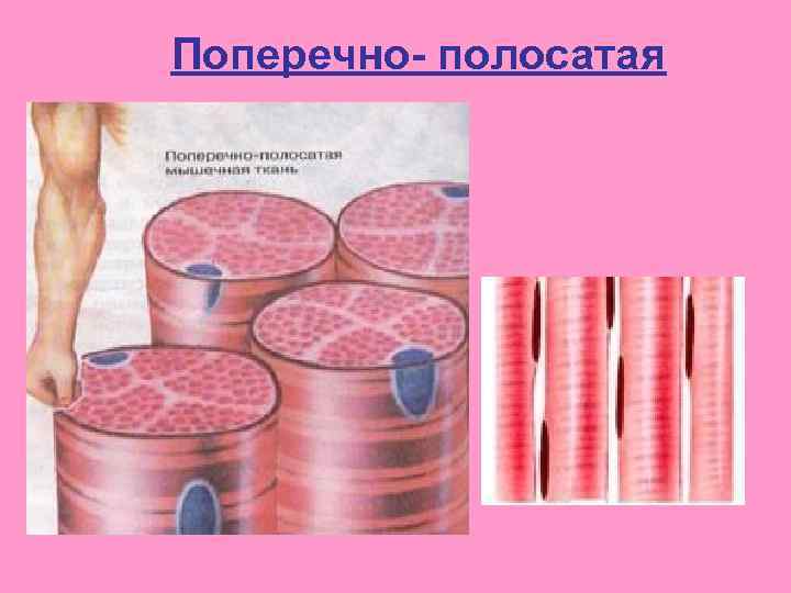 Поперечно- полосатая 