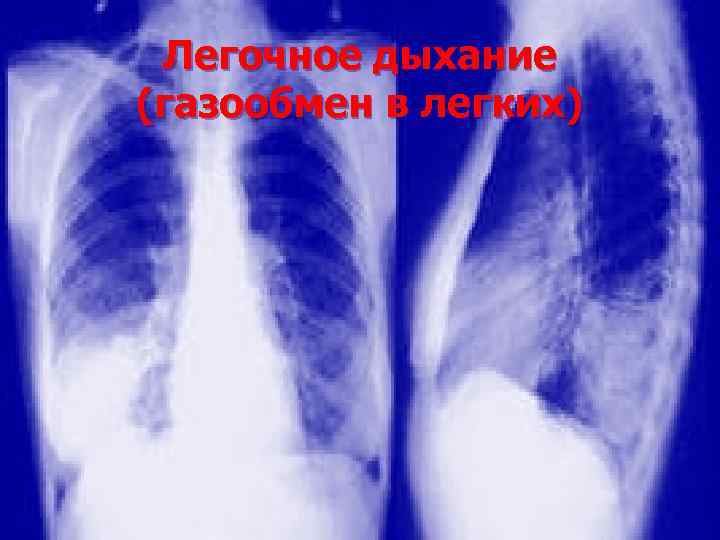 Легочное дыхание (газообмен в легких) 