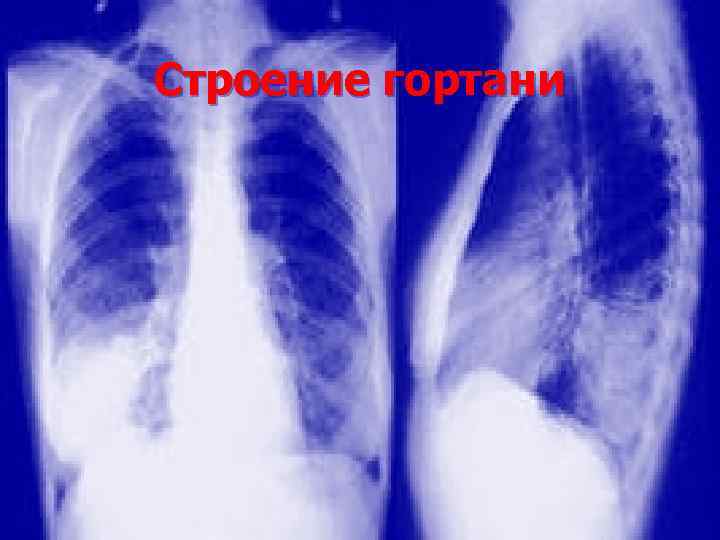 Строение гортани 