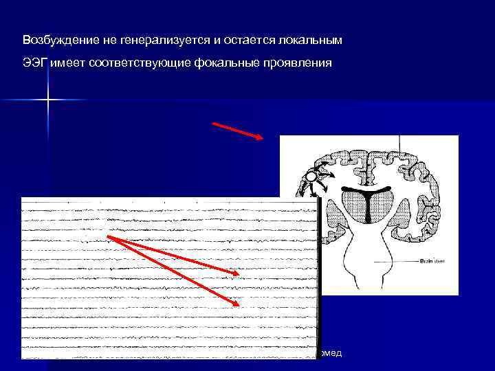 Эпилепсия локальный статус карта вызова