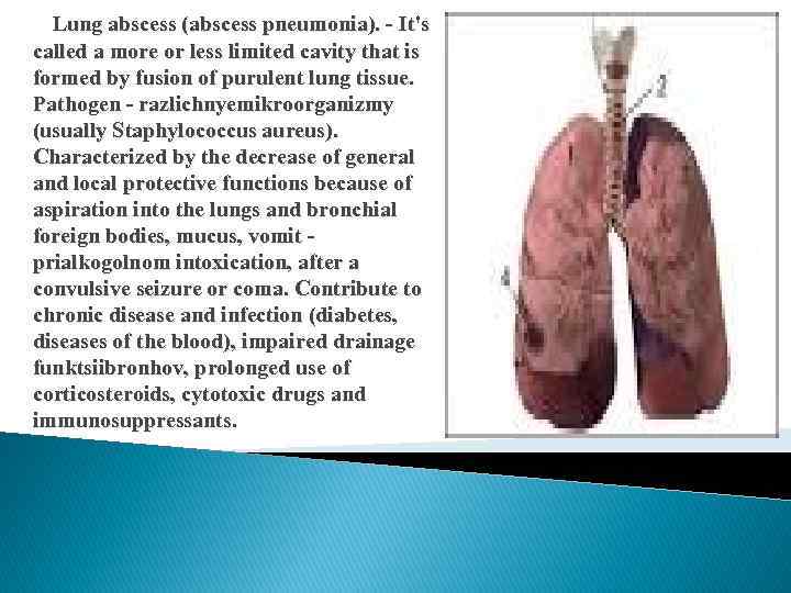 Lung abscess (abscess pneumonia). - It's called a more or less limited cavity that