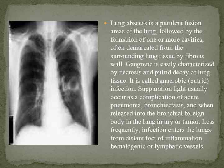 Lung abscess is a purulent fusion areas of the lung, followed by the