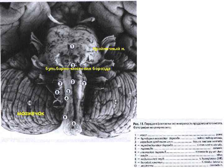 тройничный н. бульбарно-мостовая борозда мозжечок 